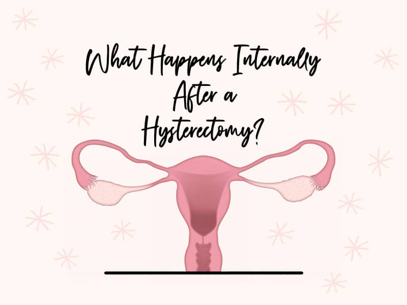 Illustration of uterus and ovaries relating to what happens internally after a hysterectomy