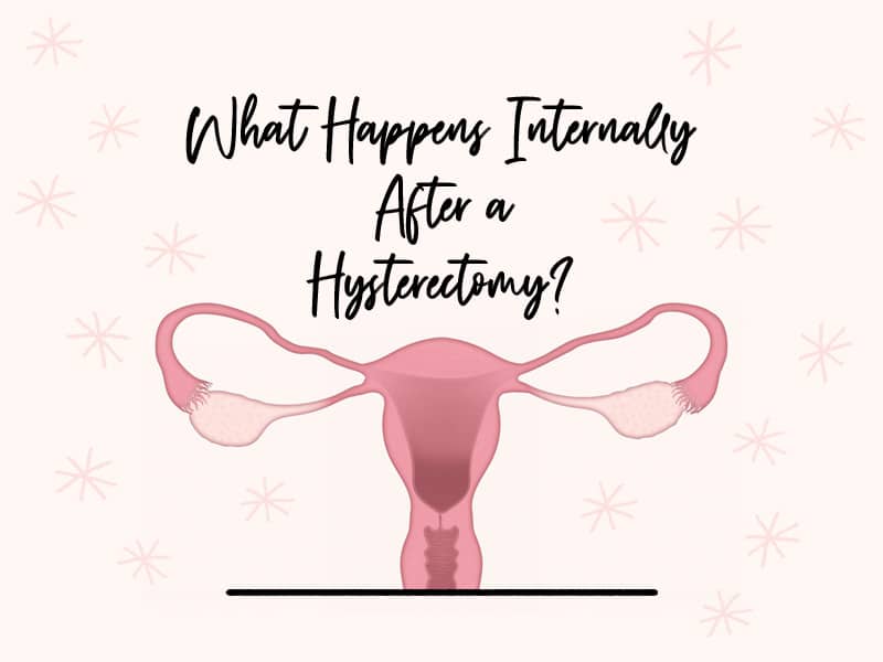 What It Feels Like After Hysterectomy