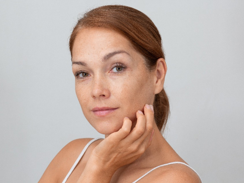 face of woman with glowing skin to illustrate intense pulsed light therapy