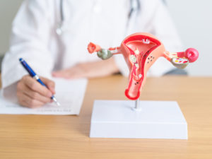 doctor with model of uterus and ovaries explaining types of hysterectomy