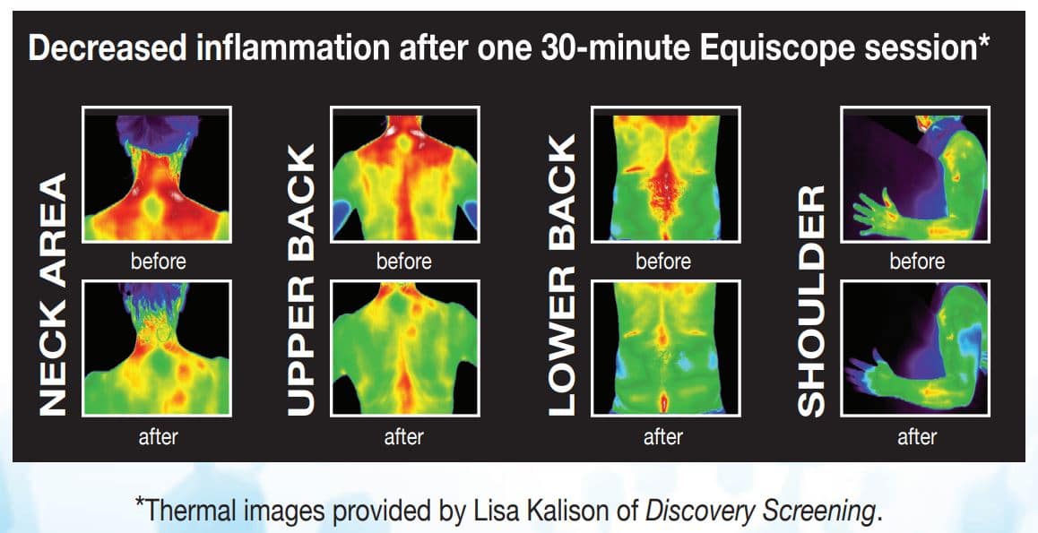 Benefits of the Equiscope