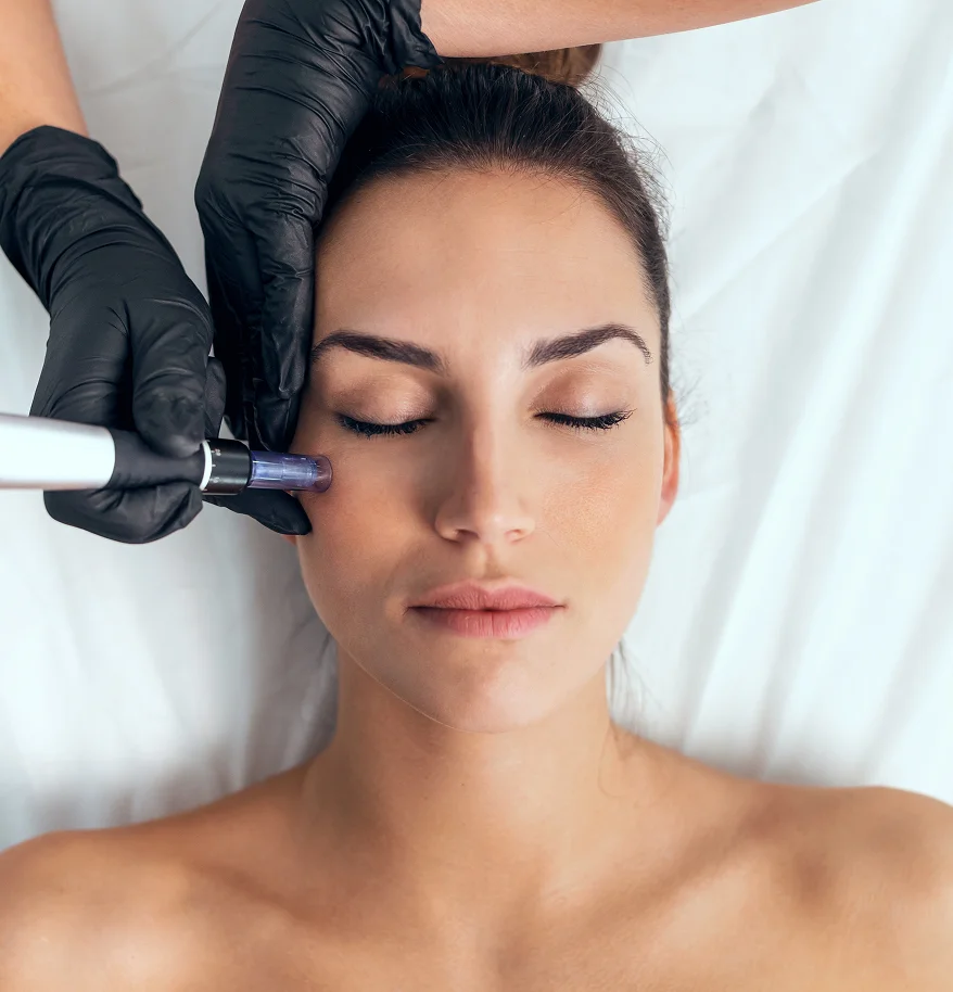 Ideal Candidates for Microneedling Services