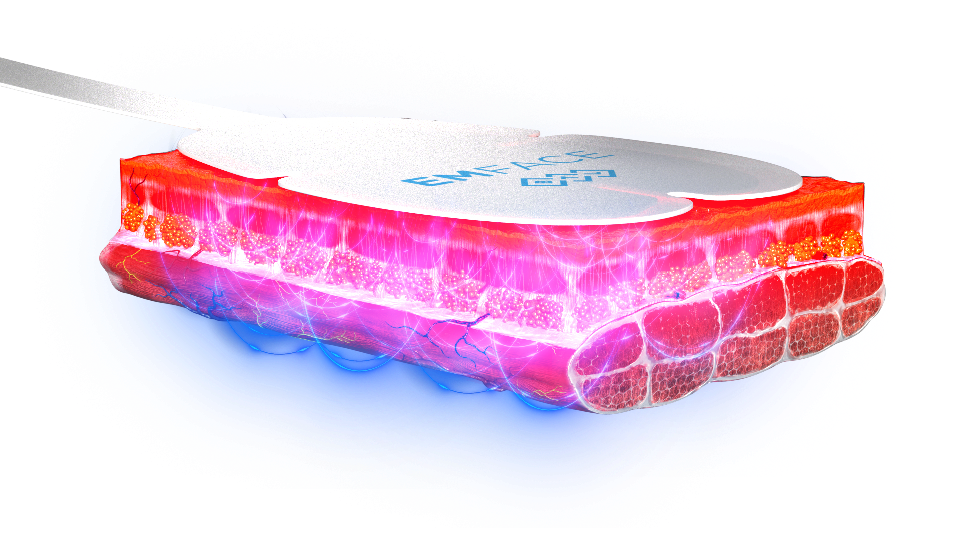 What Emface Treats & Improves 